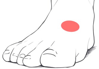 足の甲の痛み 原因 リスフランじん帯損傷