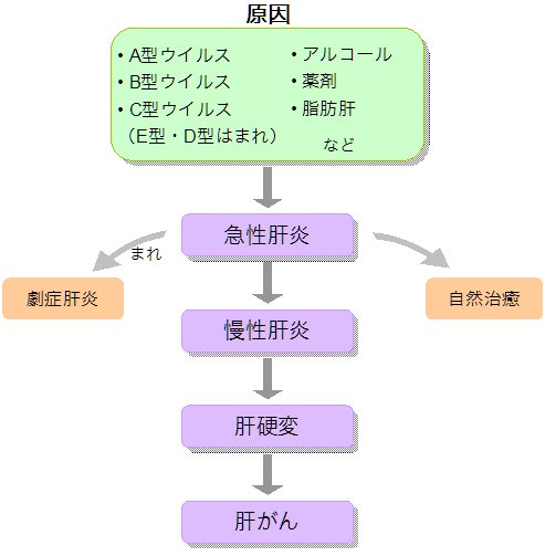 肝臓 病気 種類 肝炎の進行