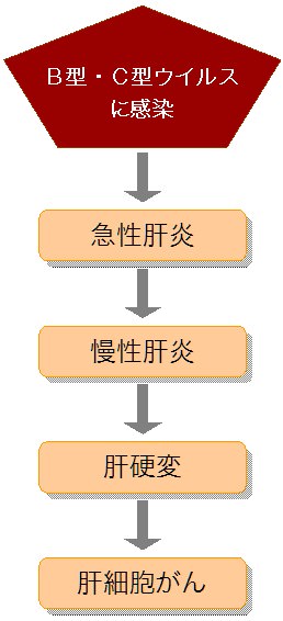 肝臓 病気 種類 肝がんの進行