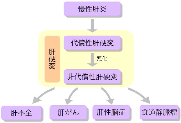 肝臓 病気 種類 肝硬変の進行