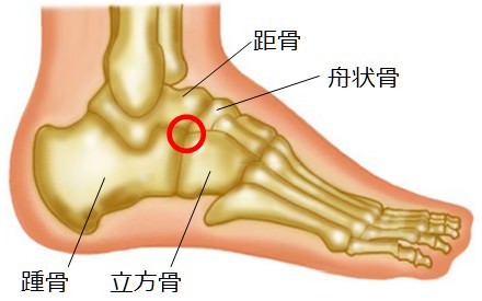 癒合症