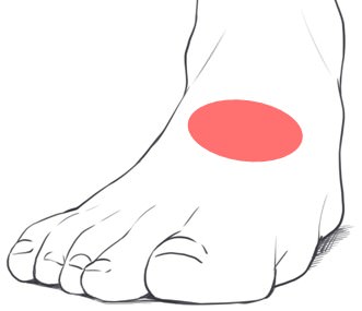 足の甲の痛み 原因 癒合症