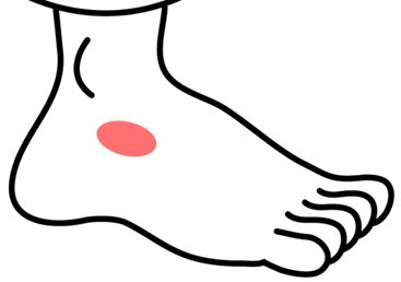 足の甲の痛み 原因 足根洞症候群