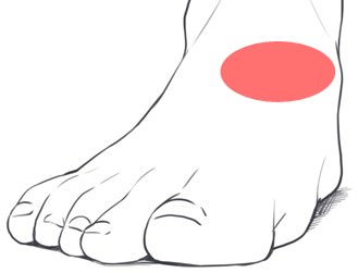 足の甲の痛み 原因 変形性足関節症