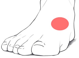 足の甲の痛み 原因 第一ケーラー病