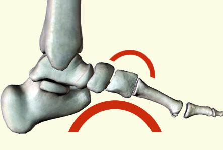 足趾伸筋腱炎