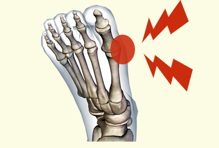 足の親指の付け根が痛い 症状ごとに図で見る11の原因 趣味なび