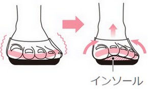 外反母趾 治し方 インソール