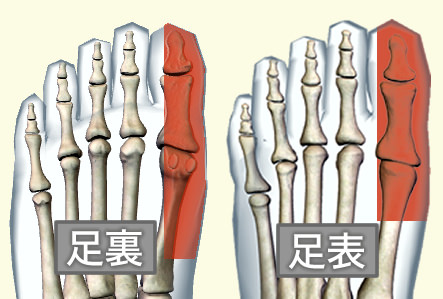 足の親指の付け根が痛い 原因 足趾の末梢神経痛