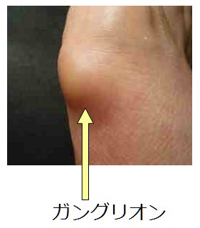 足の親指の付け根が痛い 症状ごとに図で見る11の原因 趣味なび